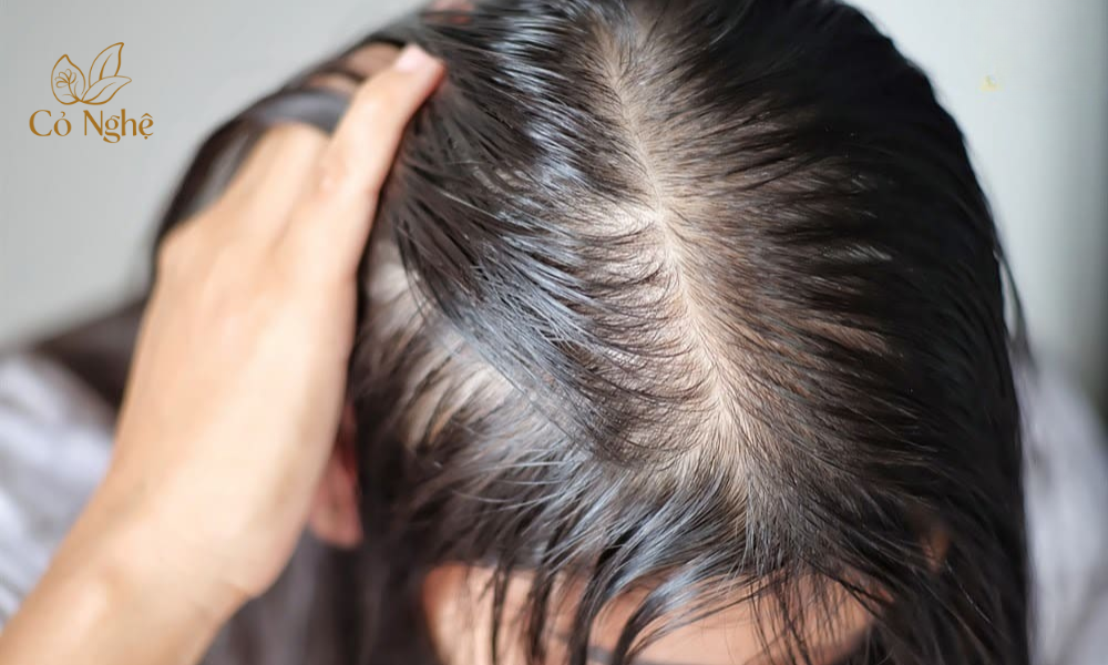 Tóc mỏng và dễ rụng